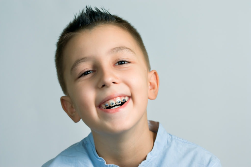 boy with braces smiling