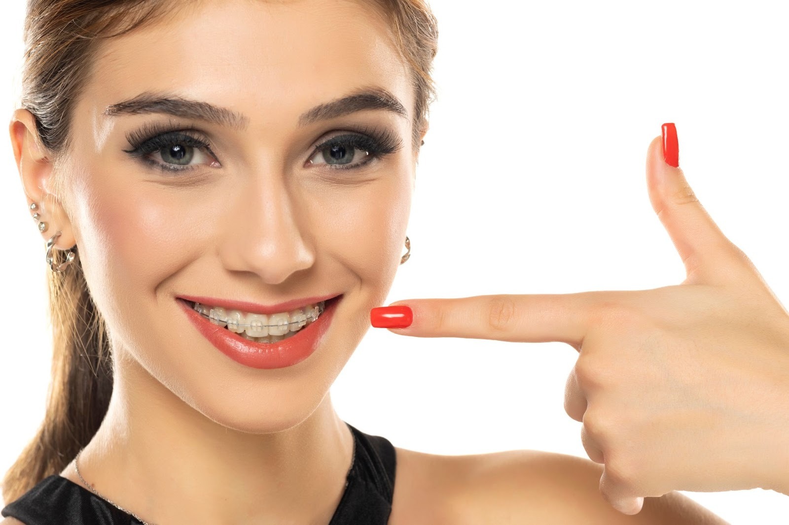 A Beginner&rsquo;s Guide to Clear Braces